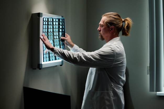 A doctor examining a digital X-ray image on a large screen, with AI-powered diagnostic tools highlighting potential anomalies and areas of concern. The image symbolizes the use of artificial intelligence to enhance the accuracy and speed of medical diagnostics.